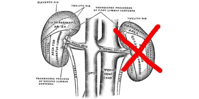 Rucking with One Kidney